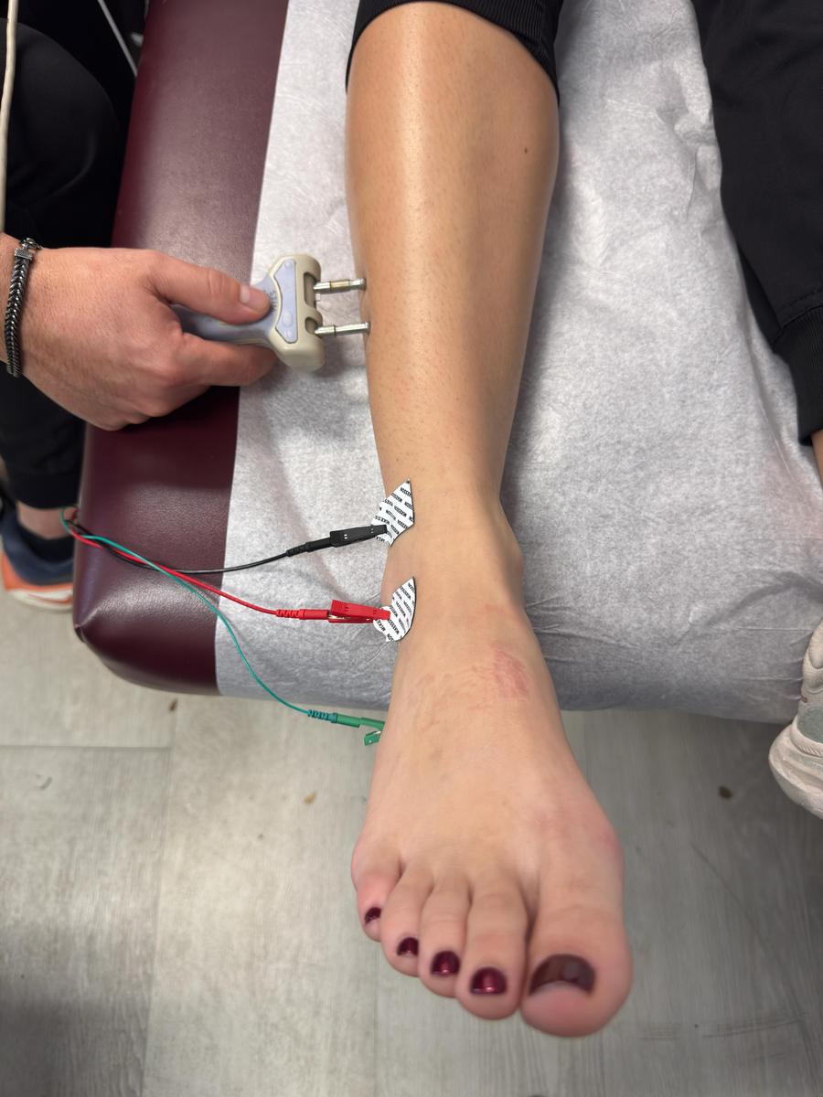 NCV wrist